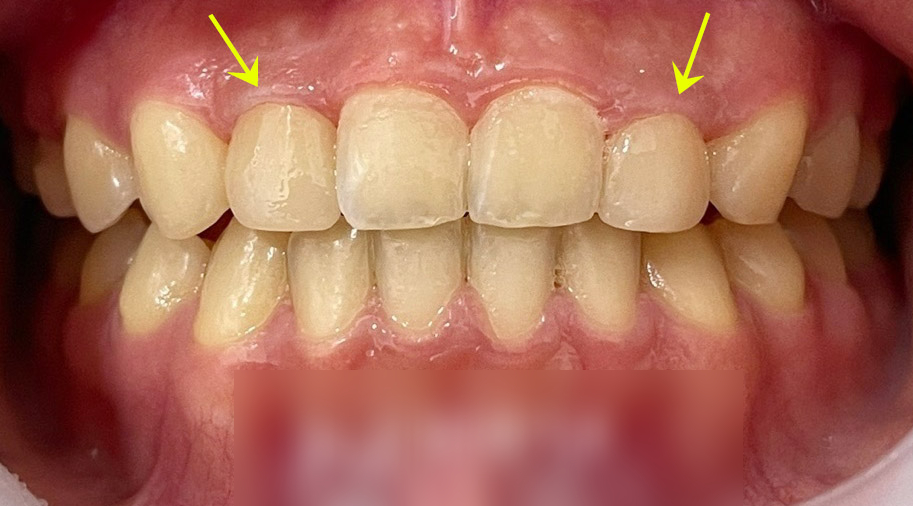 Treatment case image 5
