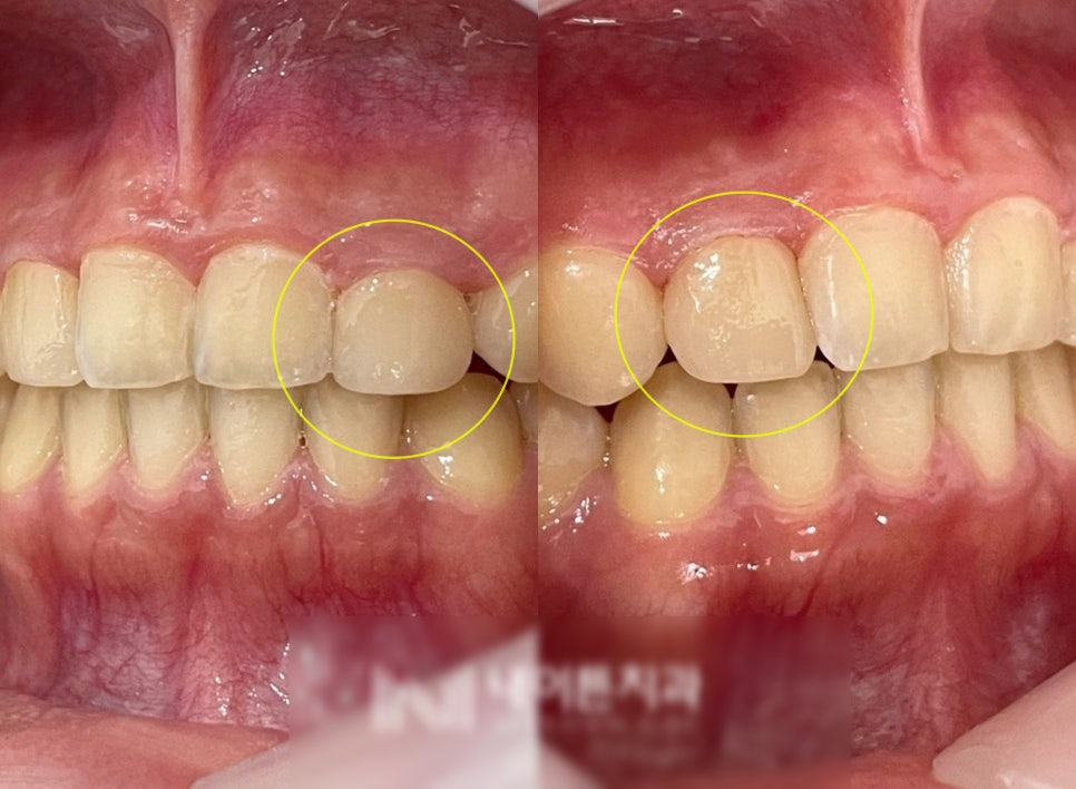 Treatment case image 6