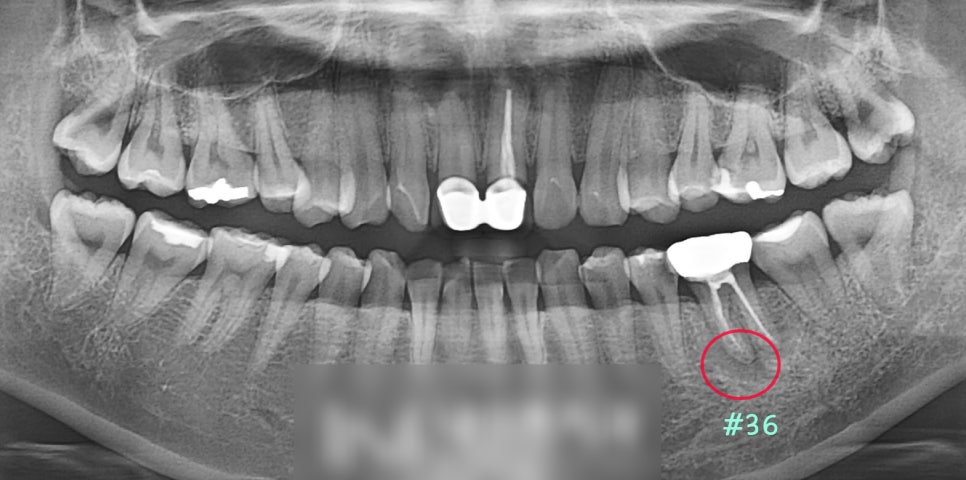 Treatment case image 1
