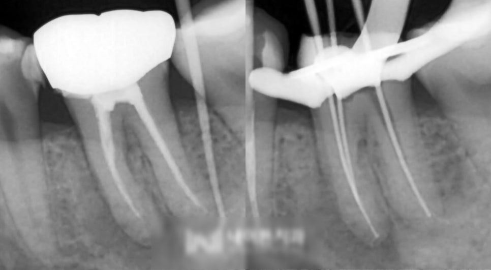 Treatment case image 3
