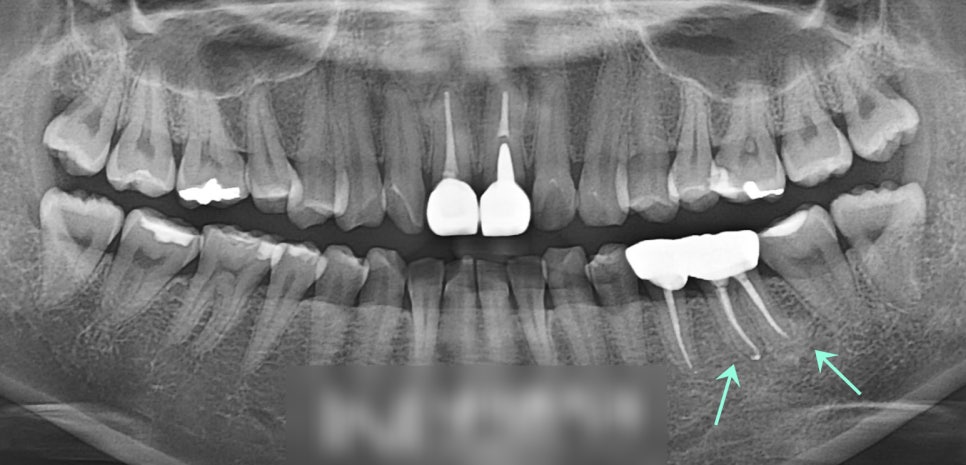 Treatment case image 4