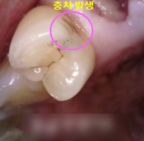Treatment case image 1
