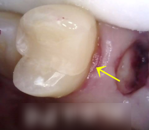 Treatment case image 3