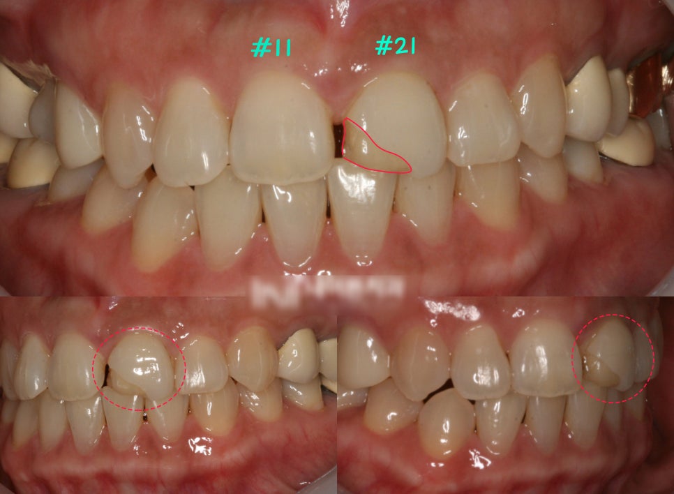 Treatment case image 1