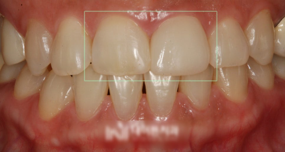 Treatment case image 3