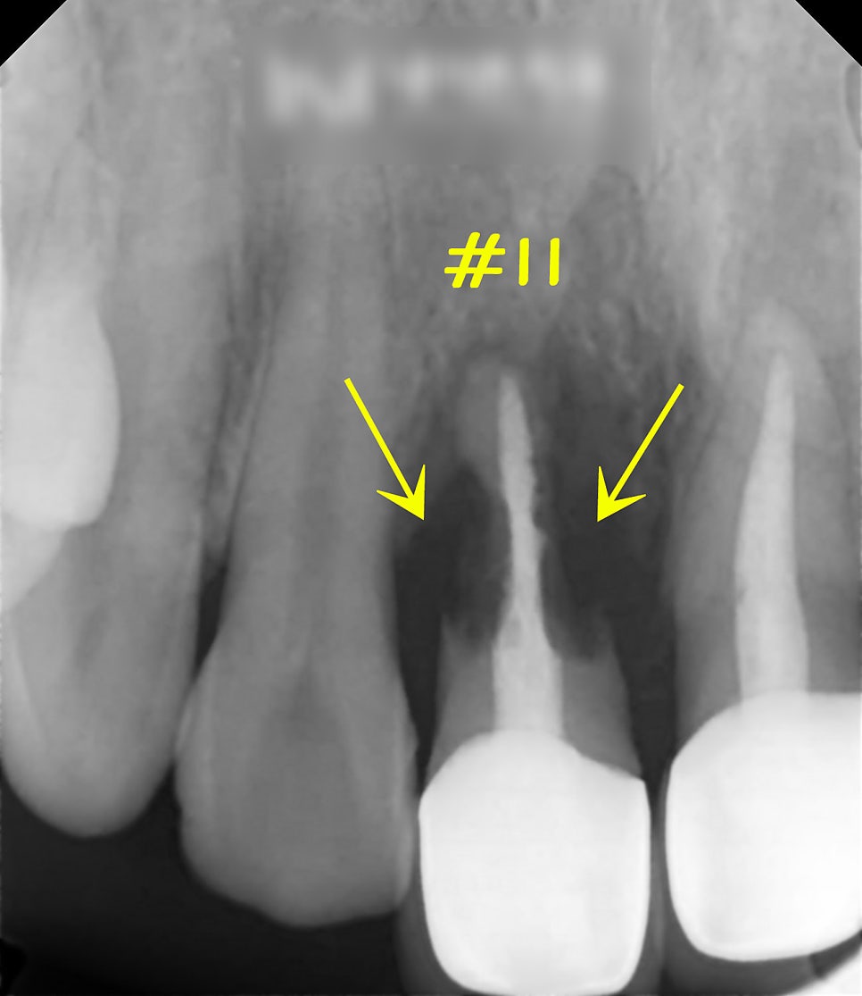 Treatment case image 1