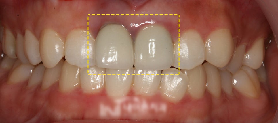Treatment case image 3
