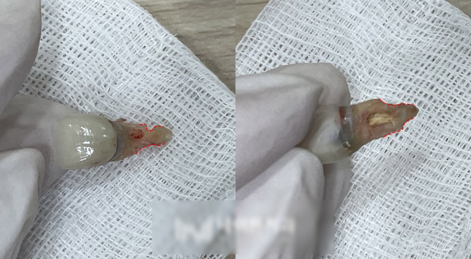 Treatment case image 4