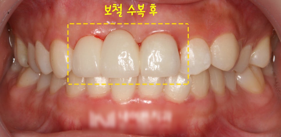 Treatment case image 5
