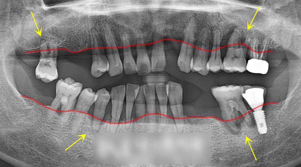 Treatment case image 1