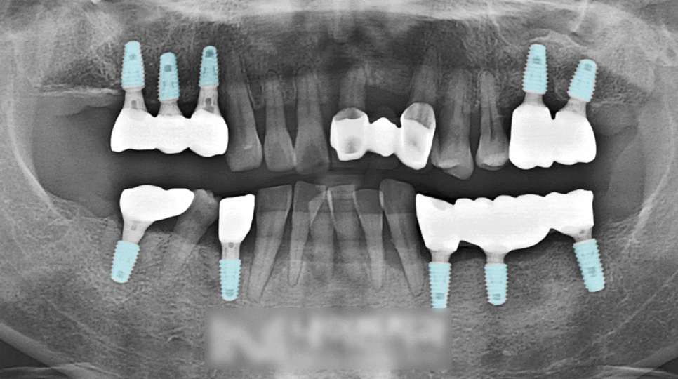 Treatment case image 3