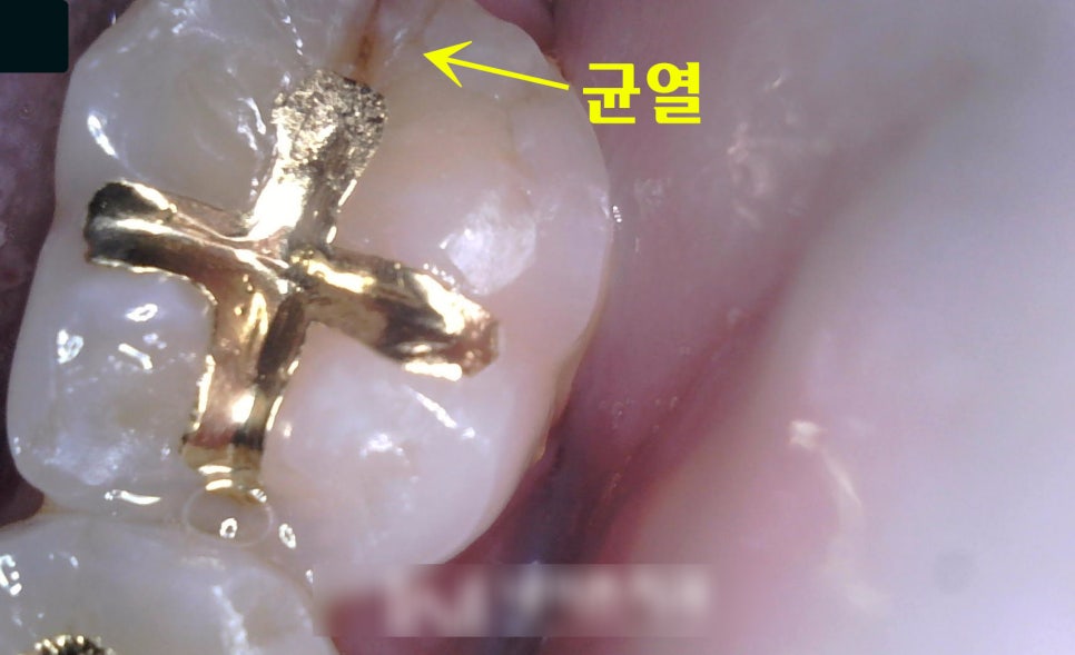 Treatment case image 1