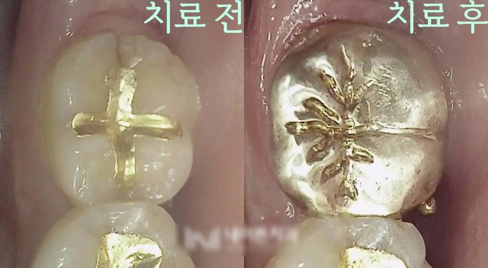 Treatment case image 2