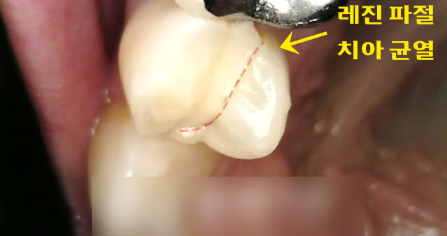 Treatment case image 1