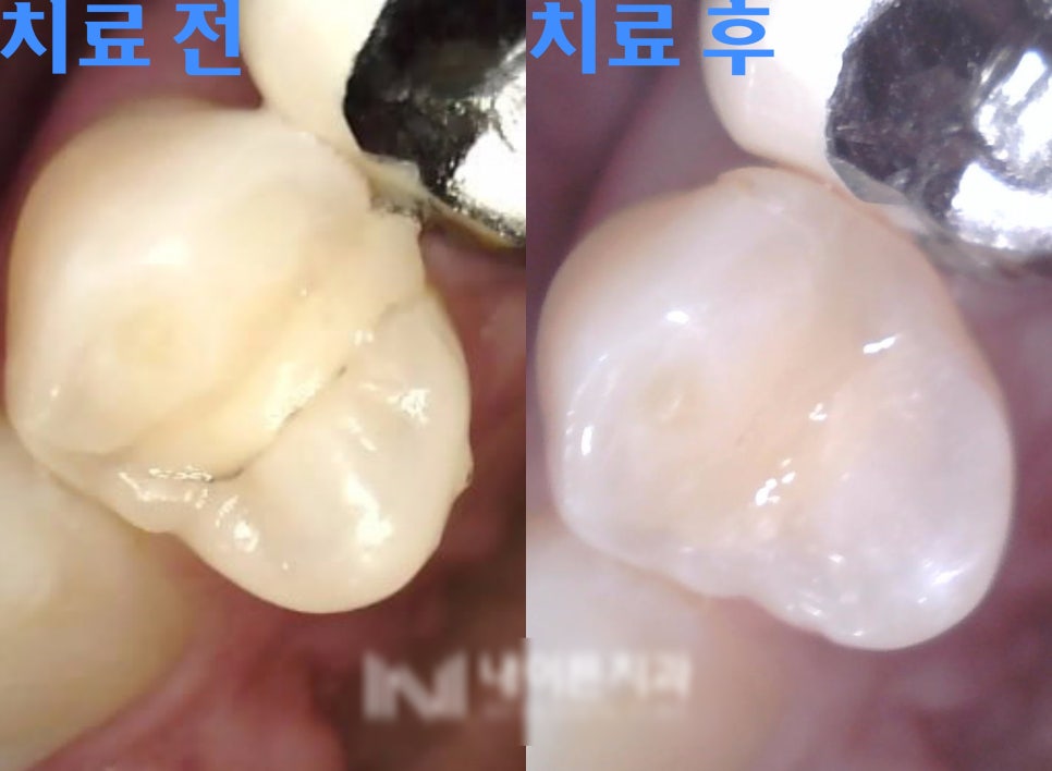 Treatment case image 3