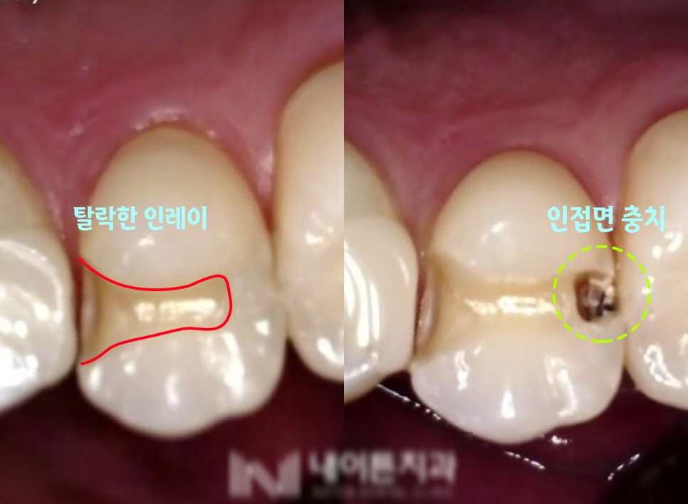 Treatment case image 1