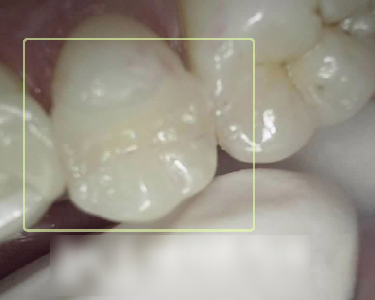 Treatment case image 3