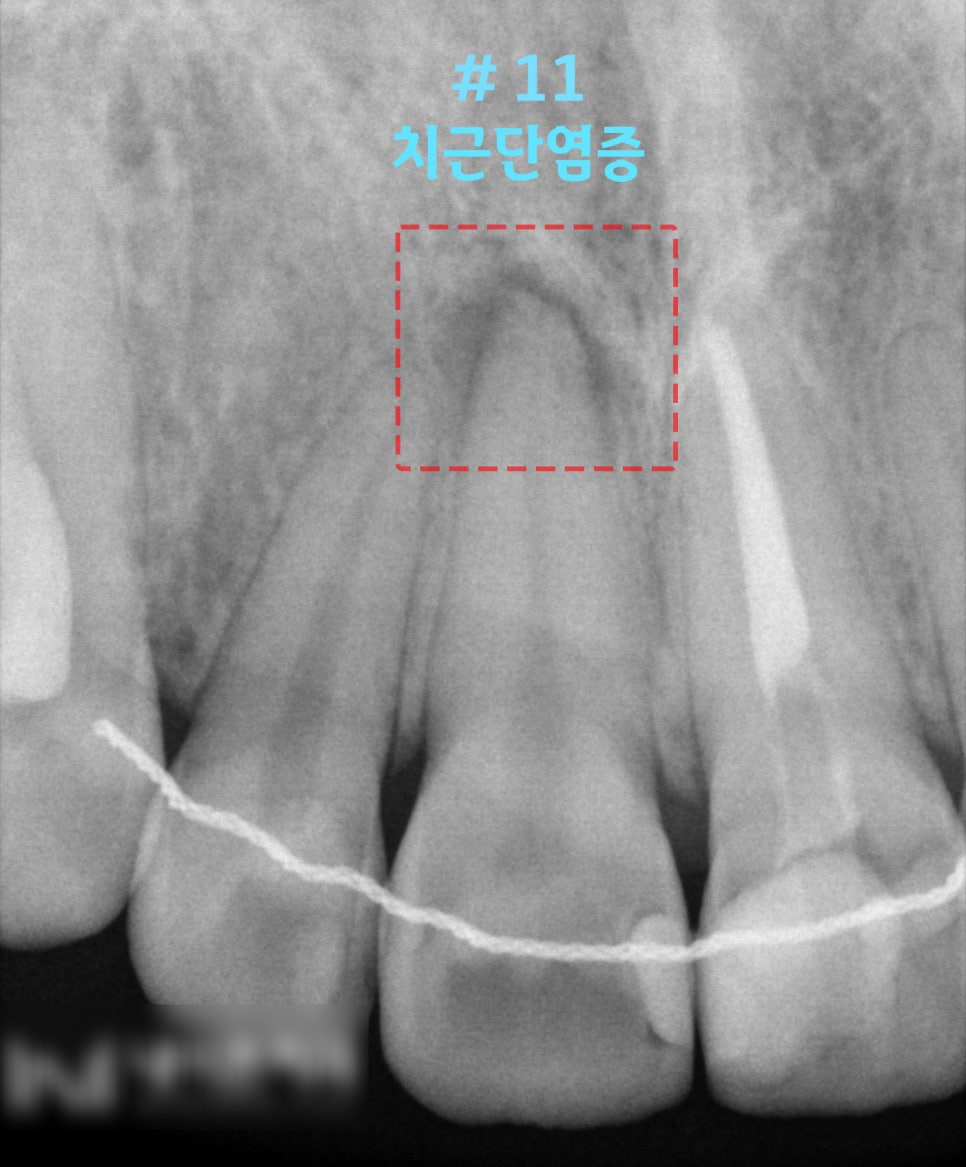 Treatment case image 1