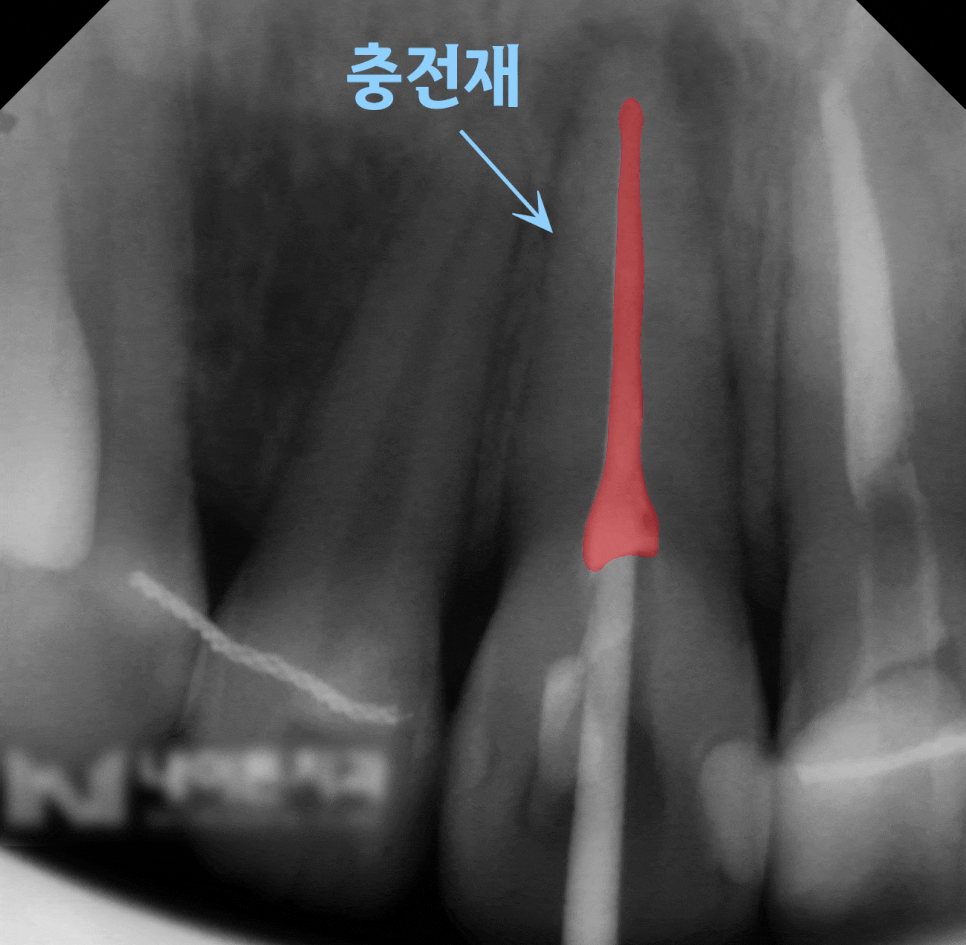 Treatment case image 3