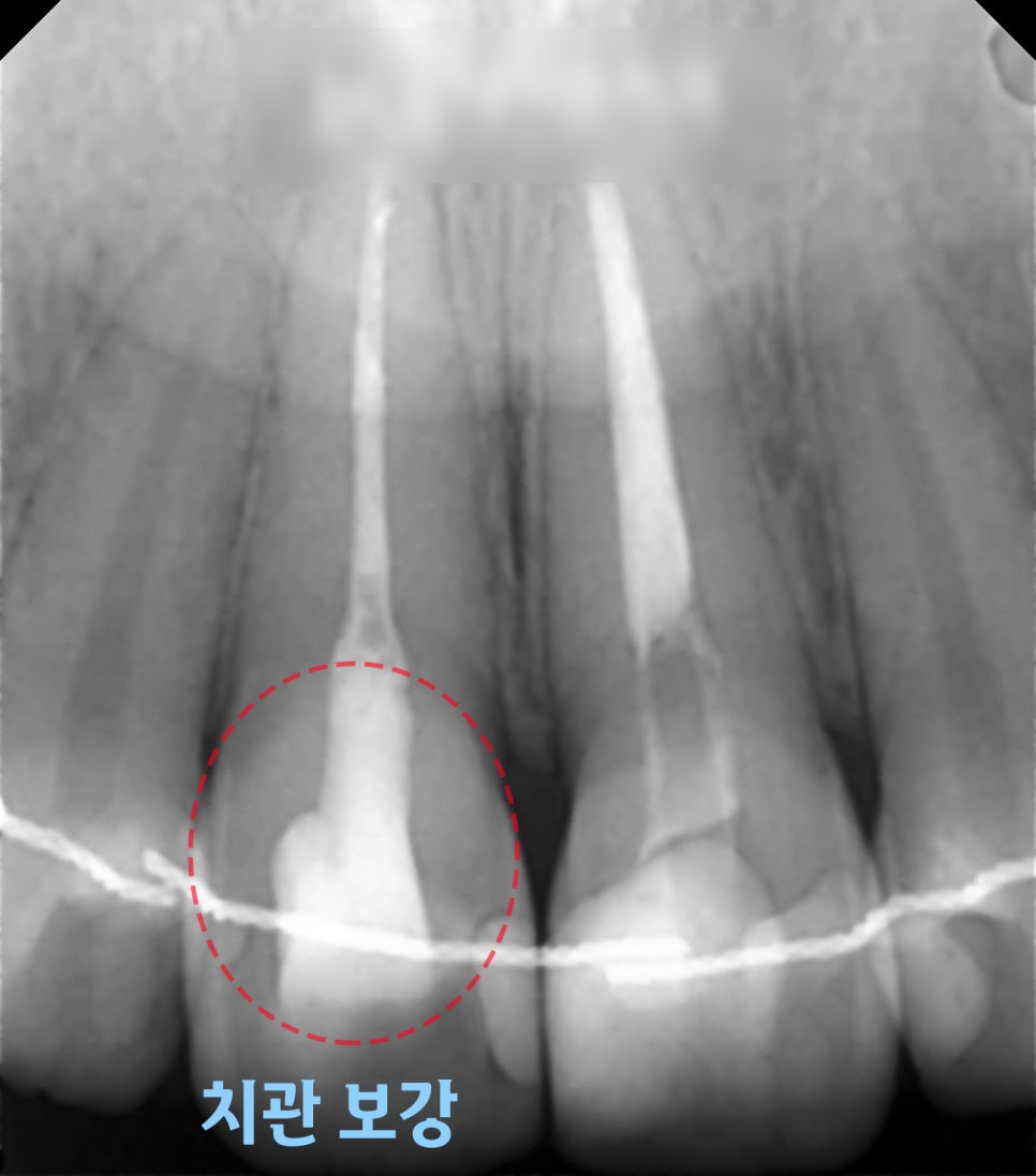 Treatment case image 5