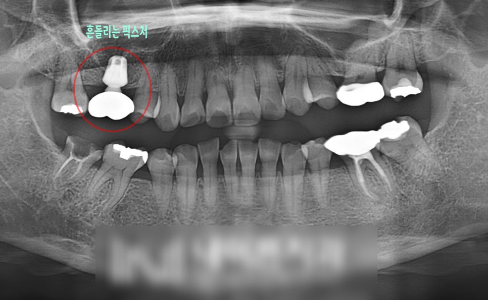 Treatment case image 1