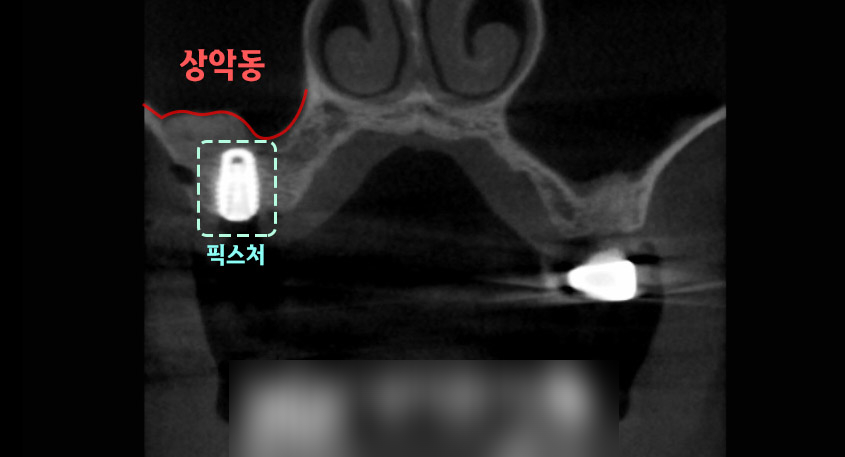 Treatment case image 2