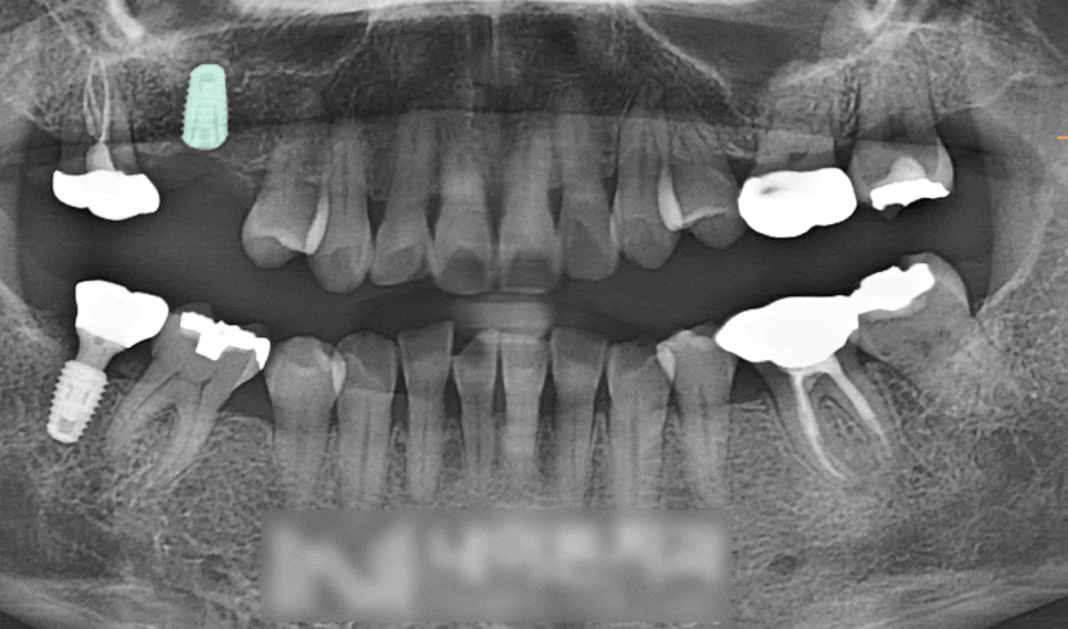 Treatment case image 5