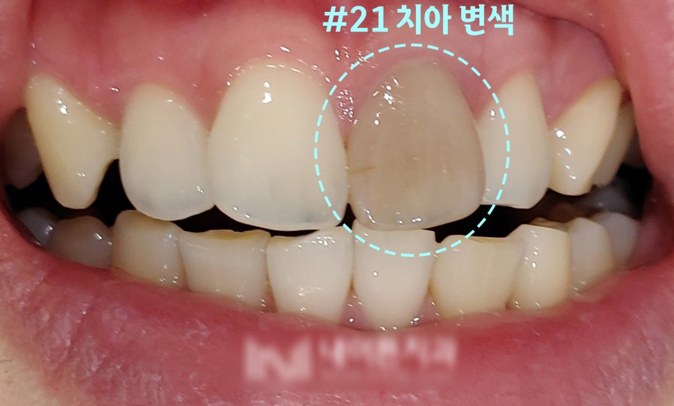 Treatment case image 1