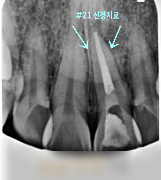 Treatment case image 3