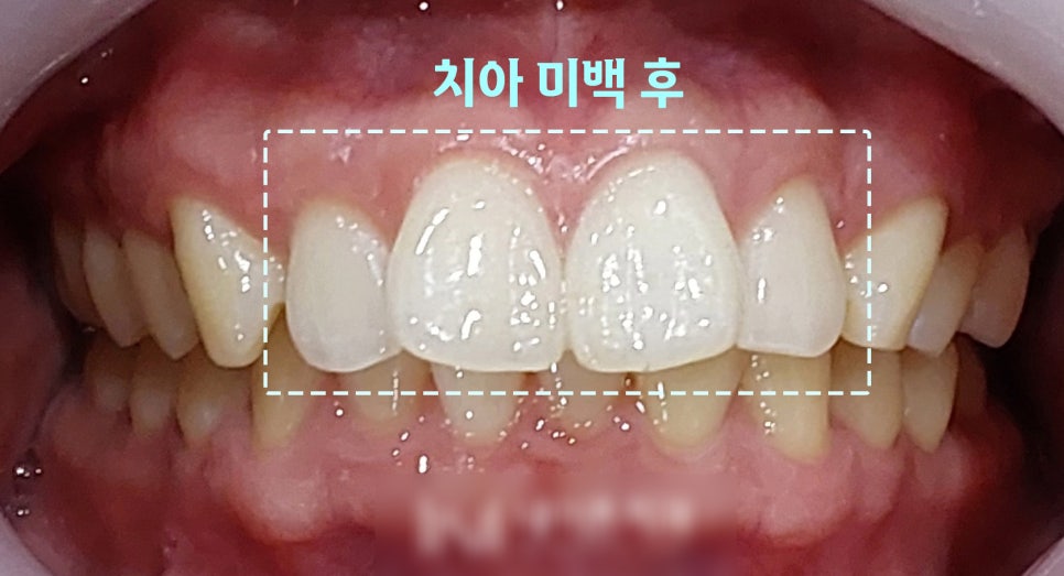 Treatment case image 4