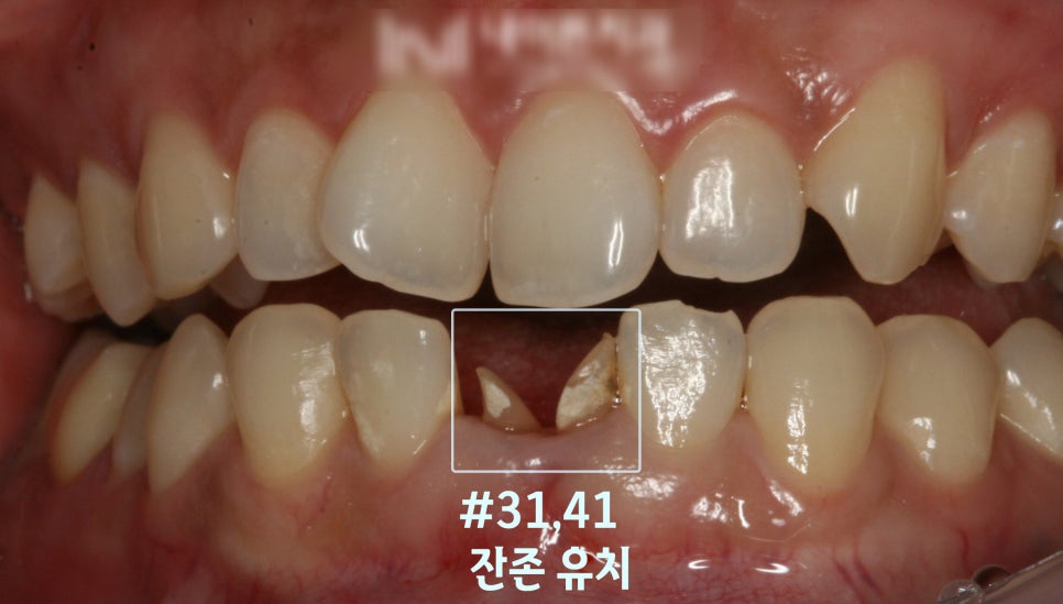 Treatment case image 1