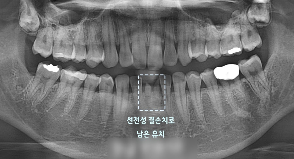 Treatment case image 2