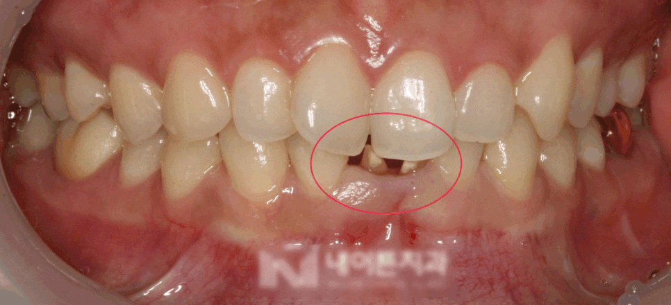 Treatment case image 5