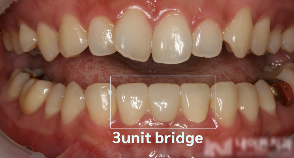 Treatment case image 6