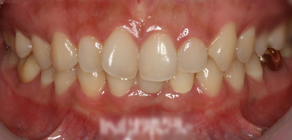 Treatment case image 7
