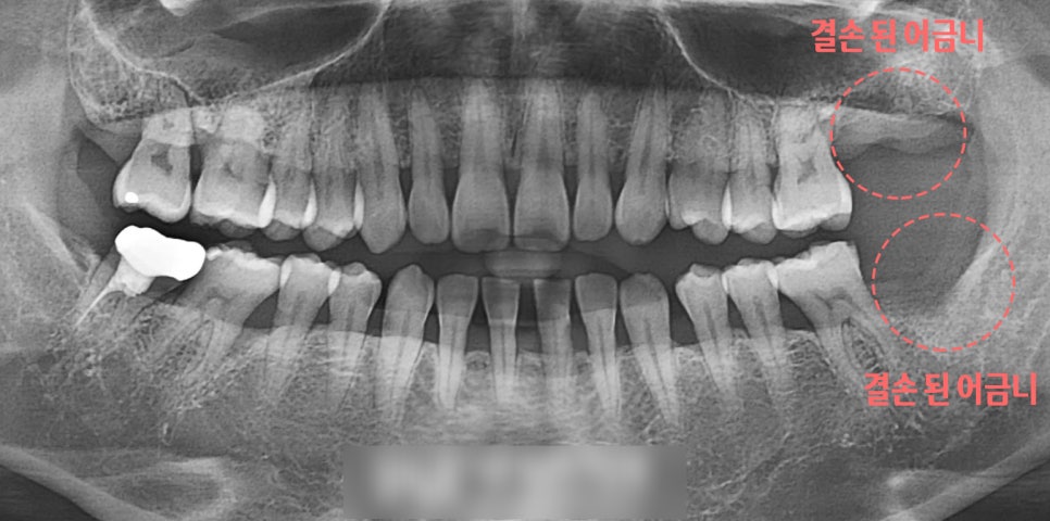 Treatment case image 1