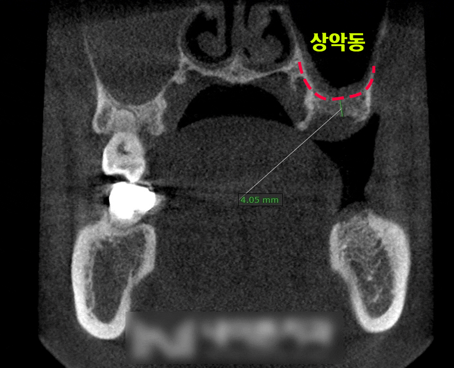 Treatment case image 2