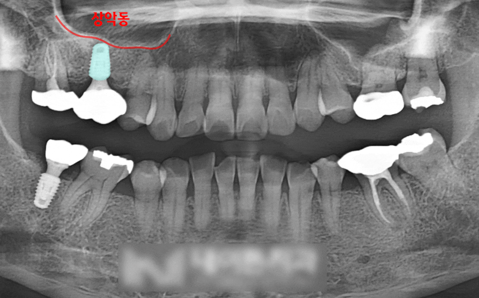 Treatment case image 5