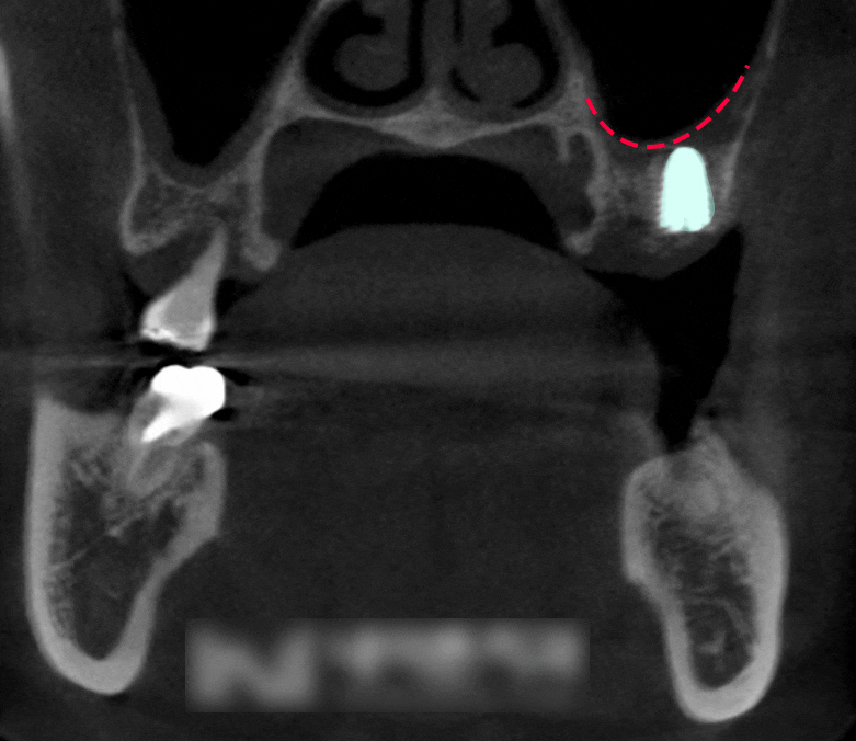 Treatment case image 6