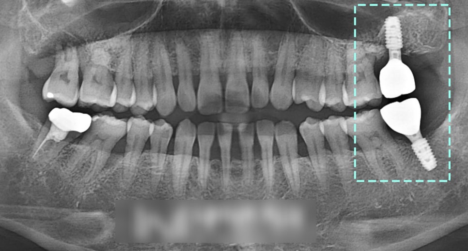 Treatment case image 8