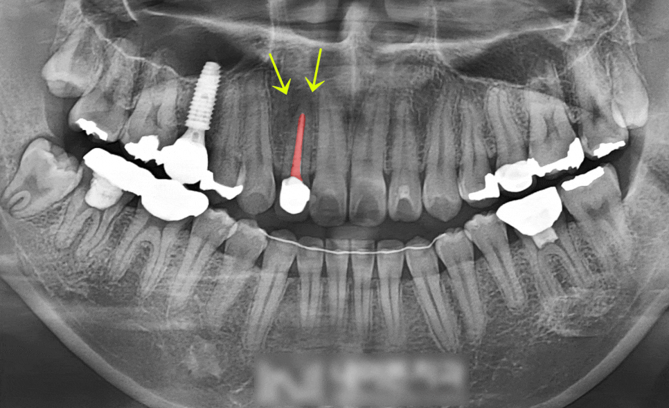 Treatment case image 1