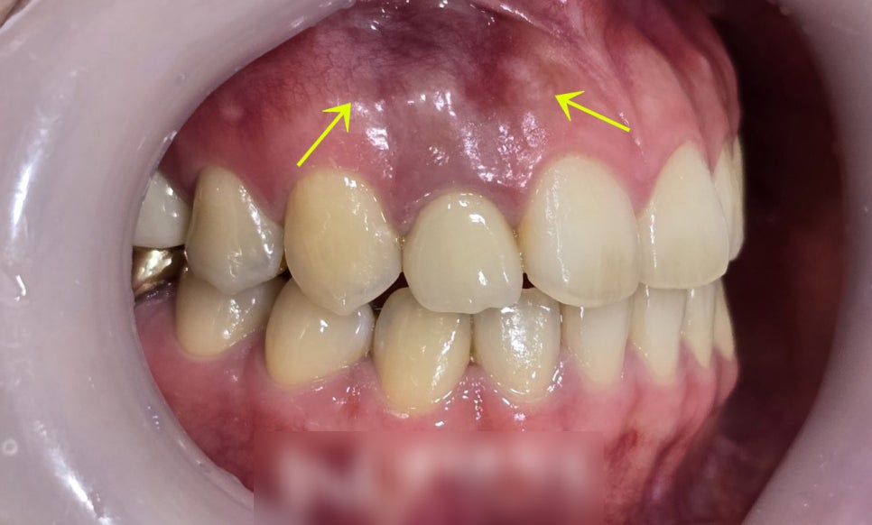 Treatment case image 2