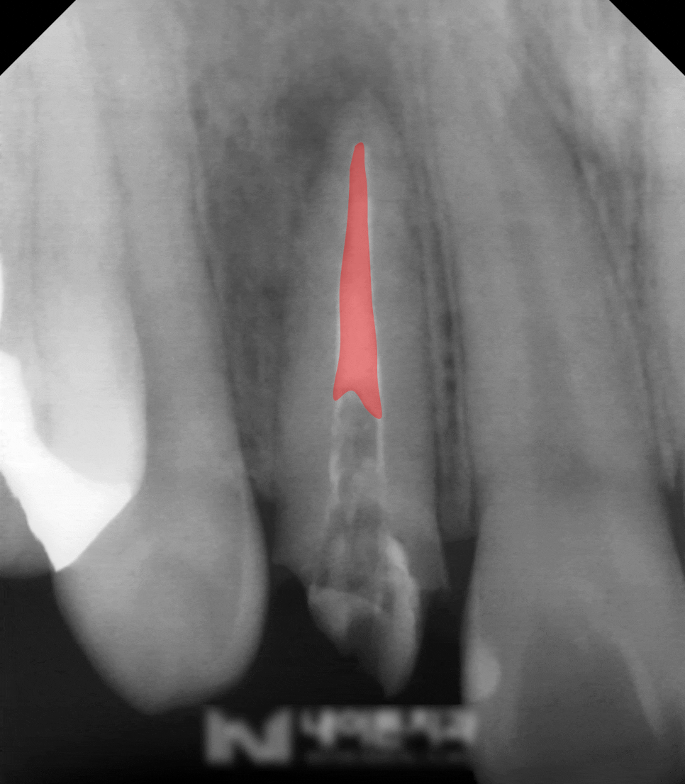 Treatment case image 3