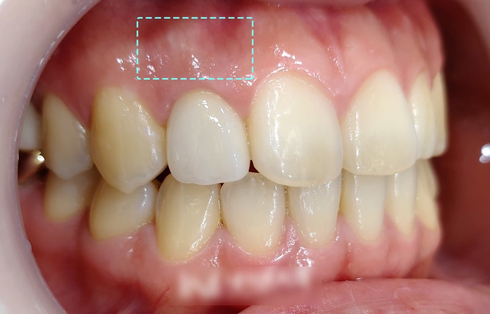 Treatment case image 6