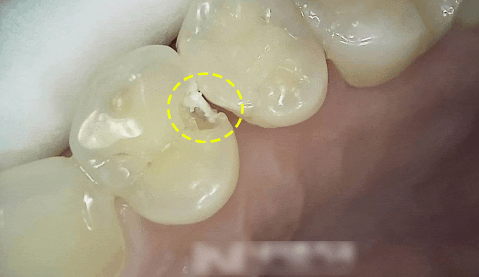 Treatment case image 1