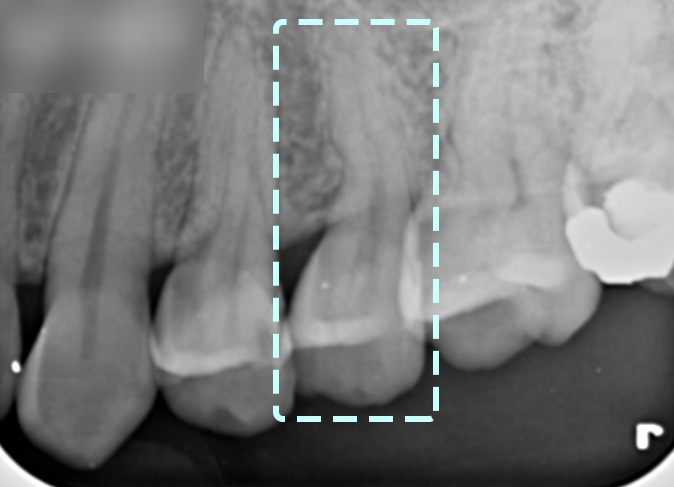 Treatment case image 3