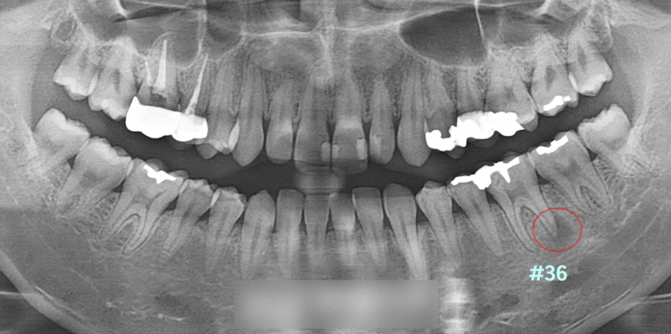 Treatment case image 1
