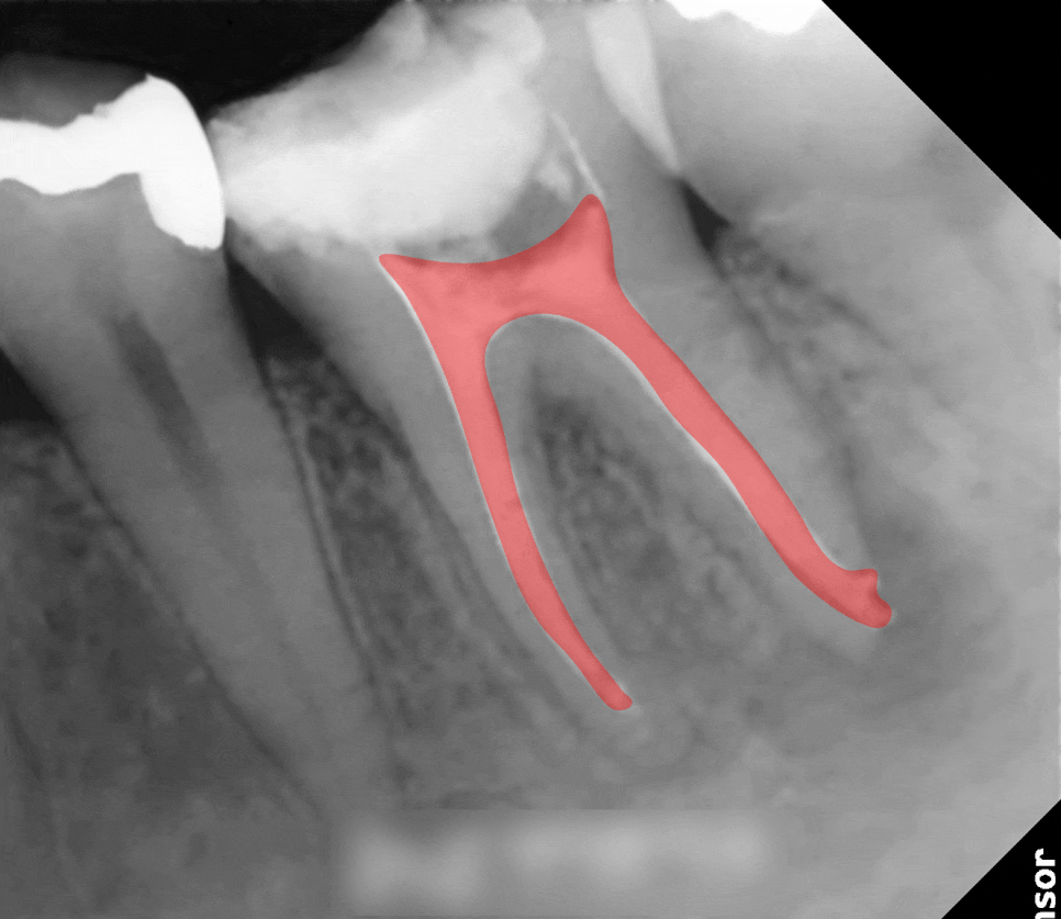 Treatment case image 2