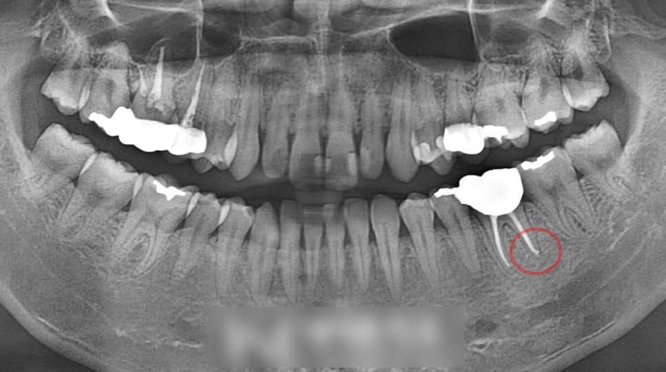 Treatment case image 3