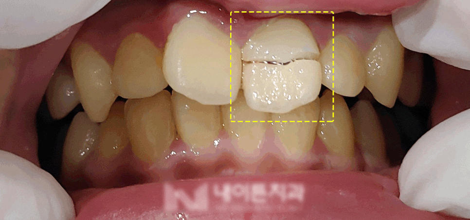 Treatment case image 1